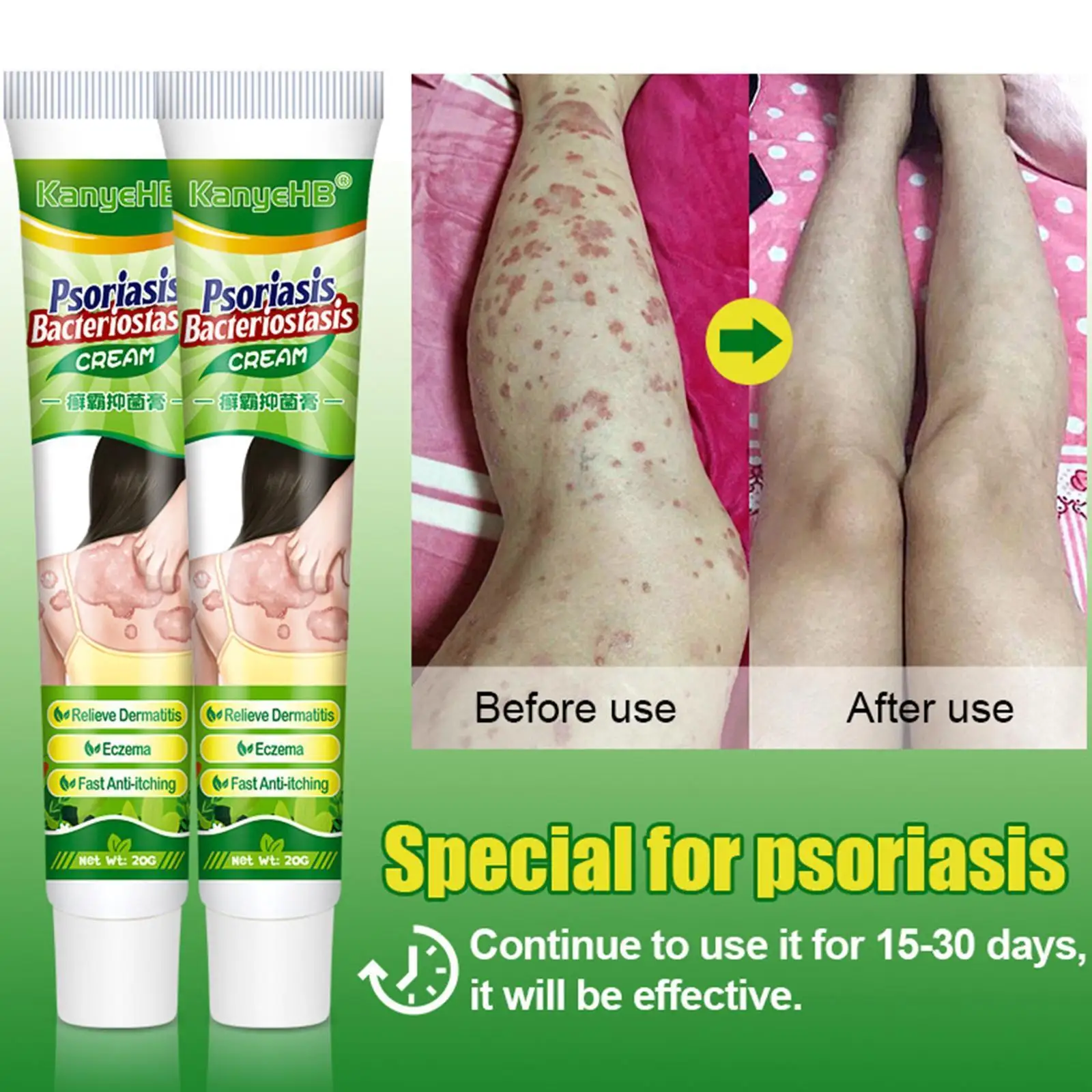 

20 г травяные материалы мазь для лечения кожных заболеваний антизуд дерматит экзема крем от псориаза крем бактериостатический M2E4