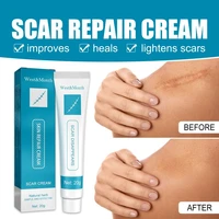 acne removal cream scar repair gel stretch marks spots burn surgical treatment cream stretch smoothing face body skin care 20g