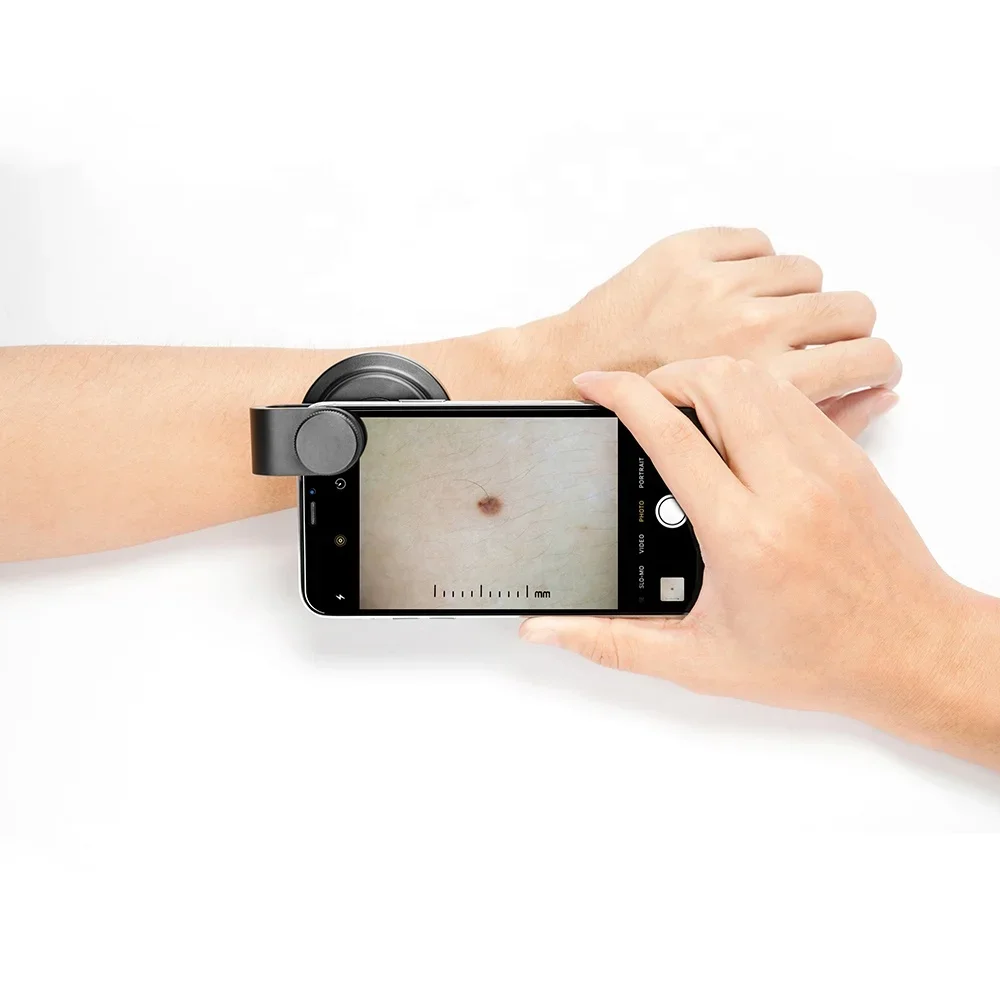 Поляризованный дерматоскоп IBOOLO DE-400 с универсальным адаптером для смартфона и