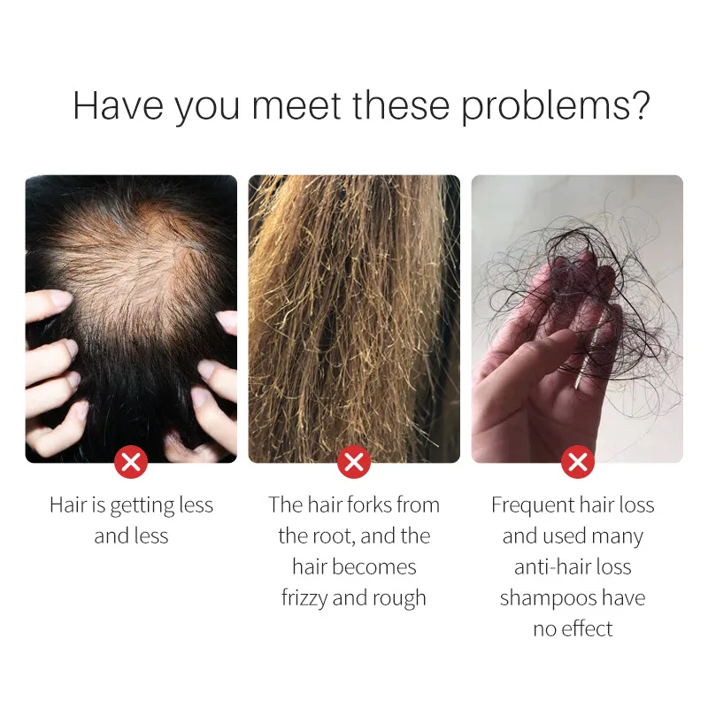 Масло для роста волос природное стимулирует восстановление фолликулов раньше