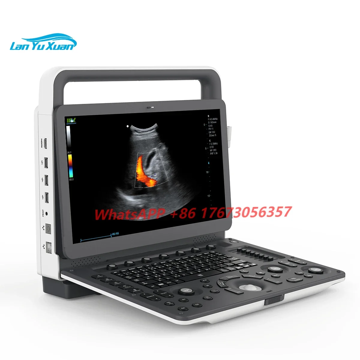 Портативный ультразвуковой допплер