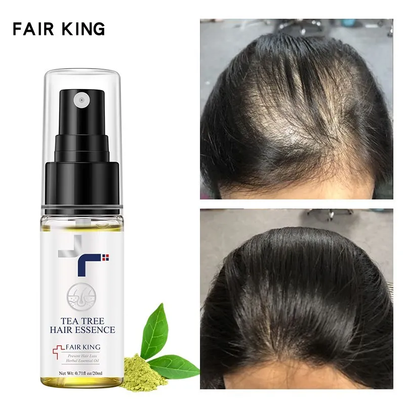 

Hair Growth Products For Men Repair Hair Follicles Strengthen Hair Roots Prevent Hair Loss Tea Essence Women's Hair Growth Oil
