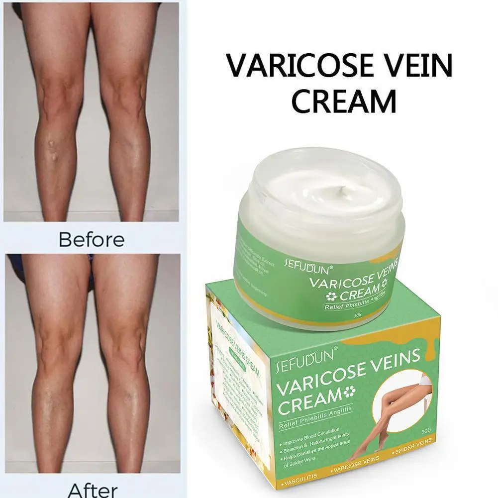 Крем для лечения варикозного расширения вен 50 г |