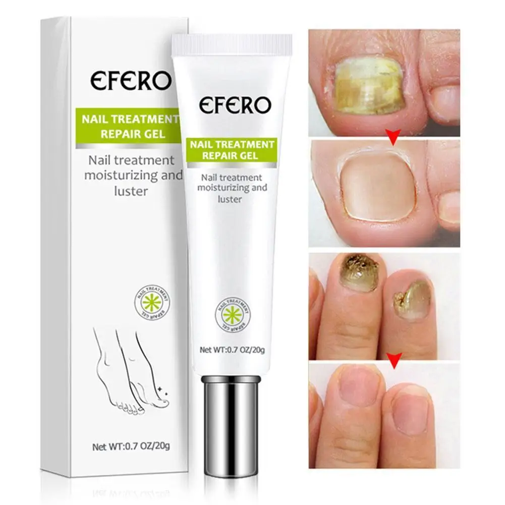 

EFERO Fungal Nail Serum Repair Essence Foot Nail Fungus Removal Gel Anti Infection Paronychia Onychomycosis Nail Treatment