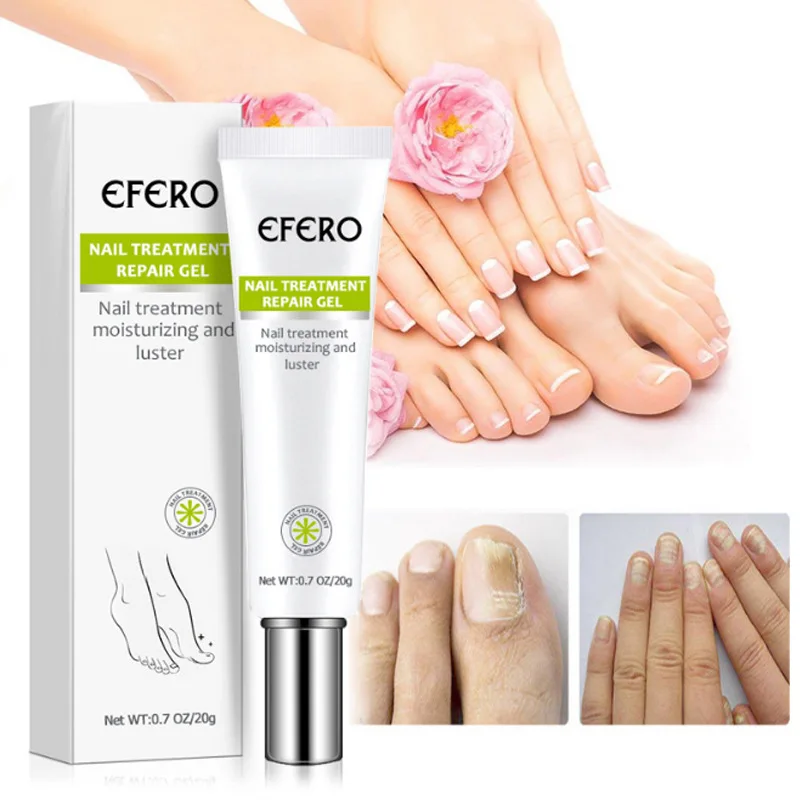 

Nail Repair Cream 20g Germ-free Nail Care Ointment Thickening Soft Nail Cream Clean Tidy Comfortable Healthy Body Care High-qual