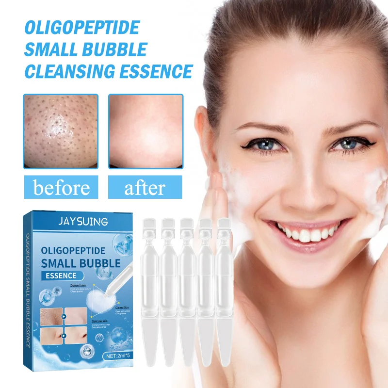 

Oligopeptide Small Bubble Essence Remove Blackhead Acne Shrink Pore face Deep Foam Cleansing Moisturizing Facial Skin Care serum