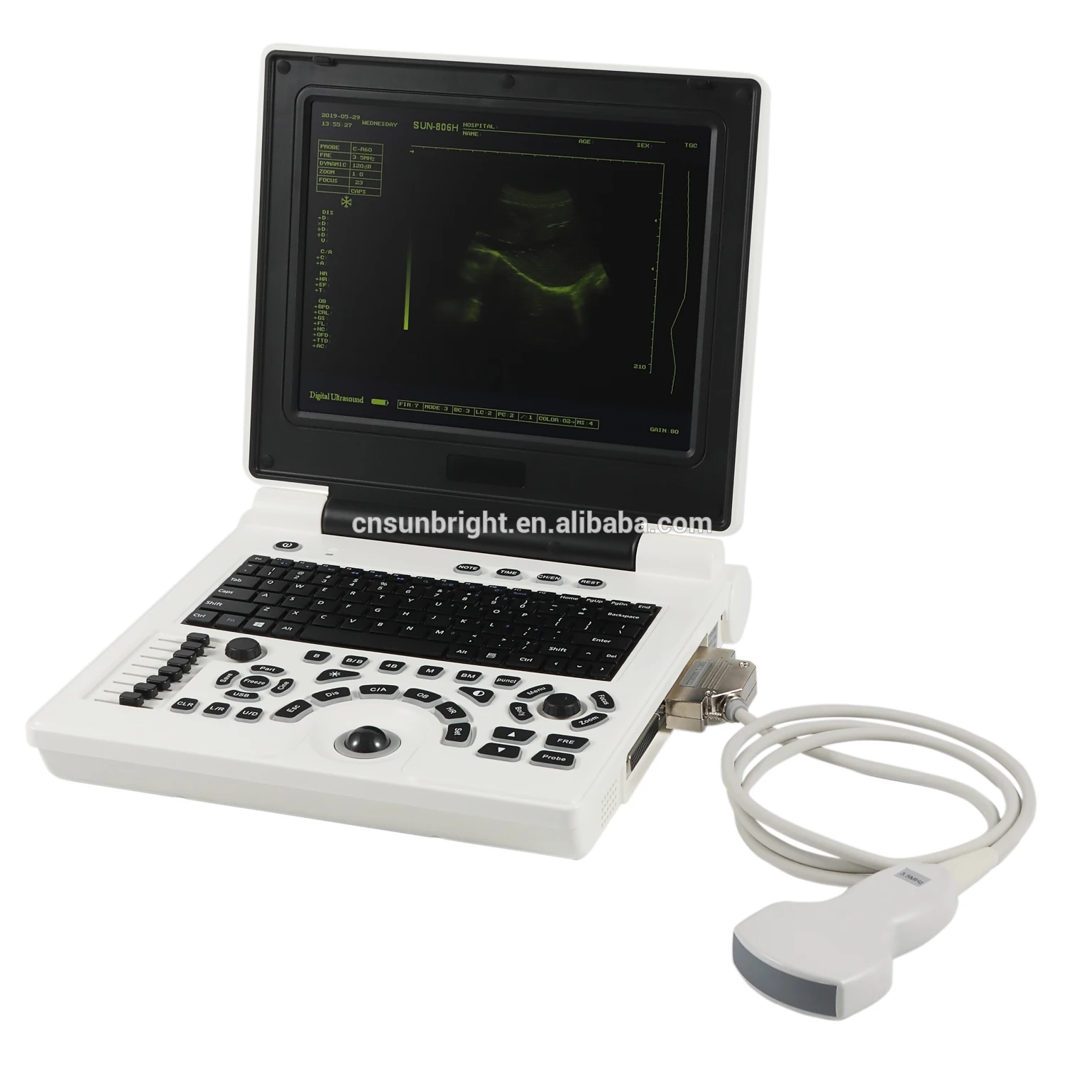 

Cheap Ecograph Laptop notebook Portable Black and White medical original ultrasound