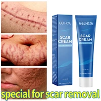 acne scar removal cream acne pimples spots repair gel stretch marks treatment whitening moisturizing smooth beauty skin care
