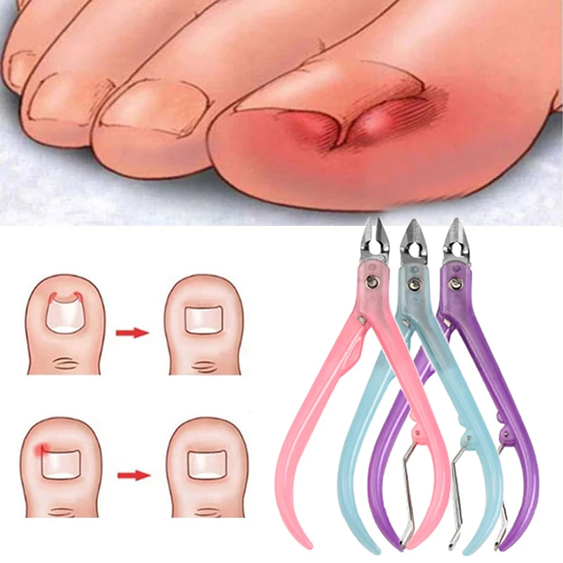 

Toe Nail Clippers Professional Cuticle Cutter Cuticle Nipper Chiropody Podiatry Exfoliating Scissors Nail Clipper Feet Care Tool