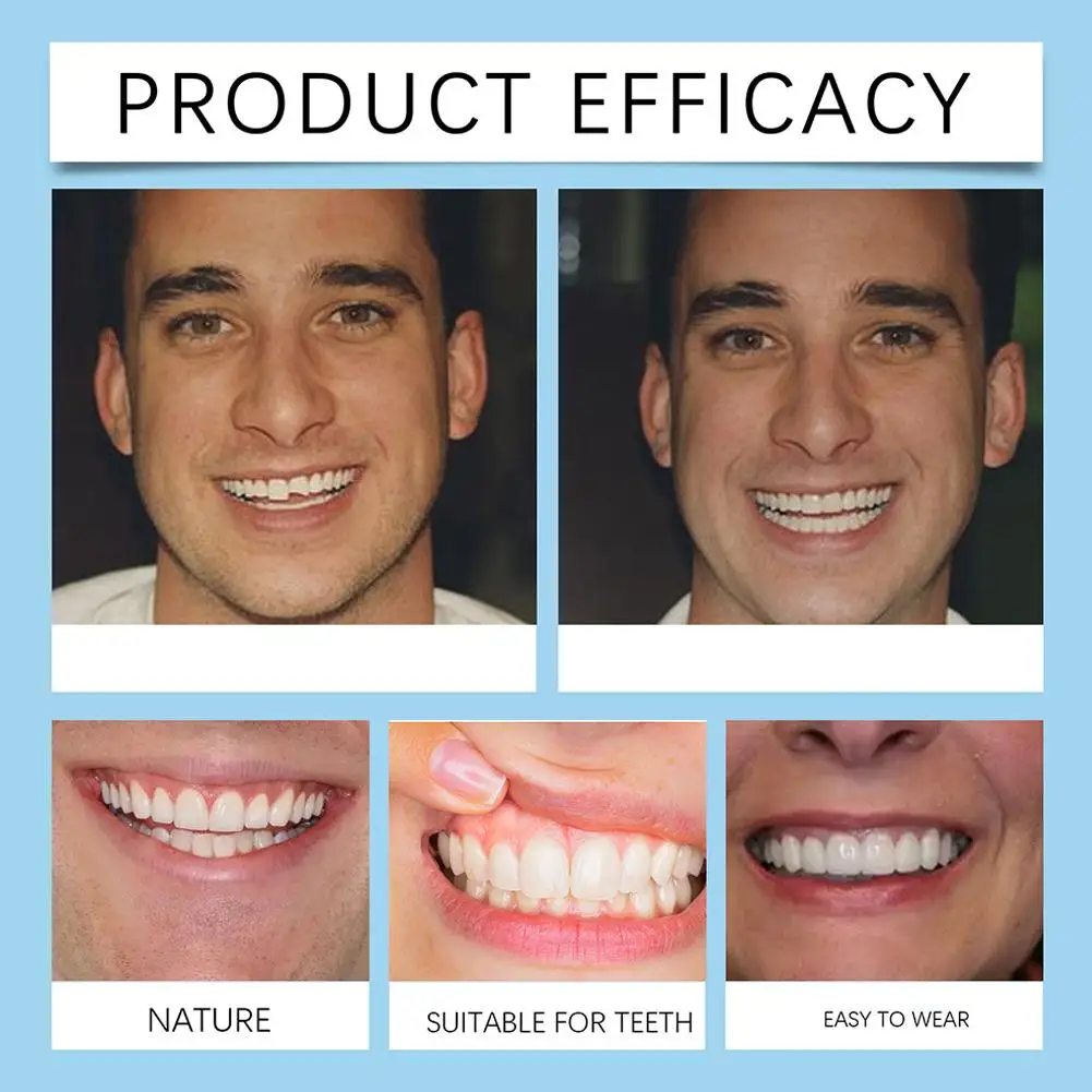 Косметические зубы Силиконовые зубные протезы Улучшают адаптируемость Удобные