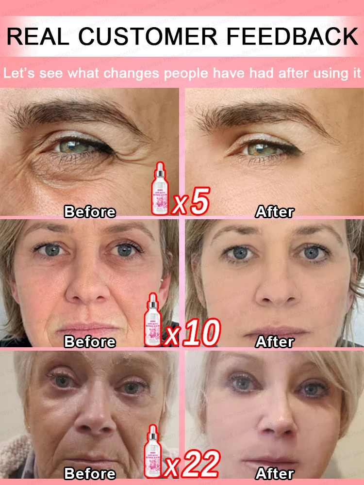 Ручная шлифовальная пилка для ног