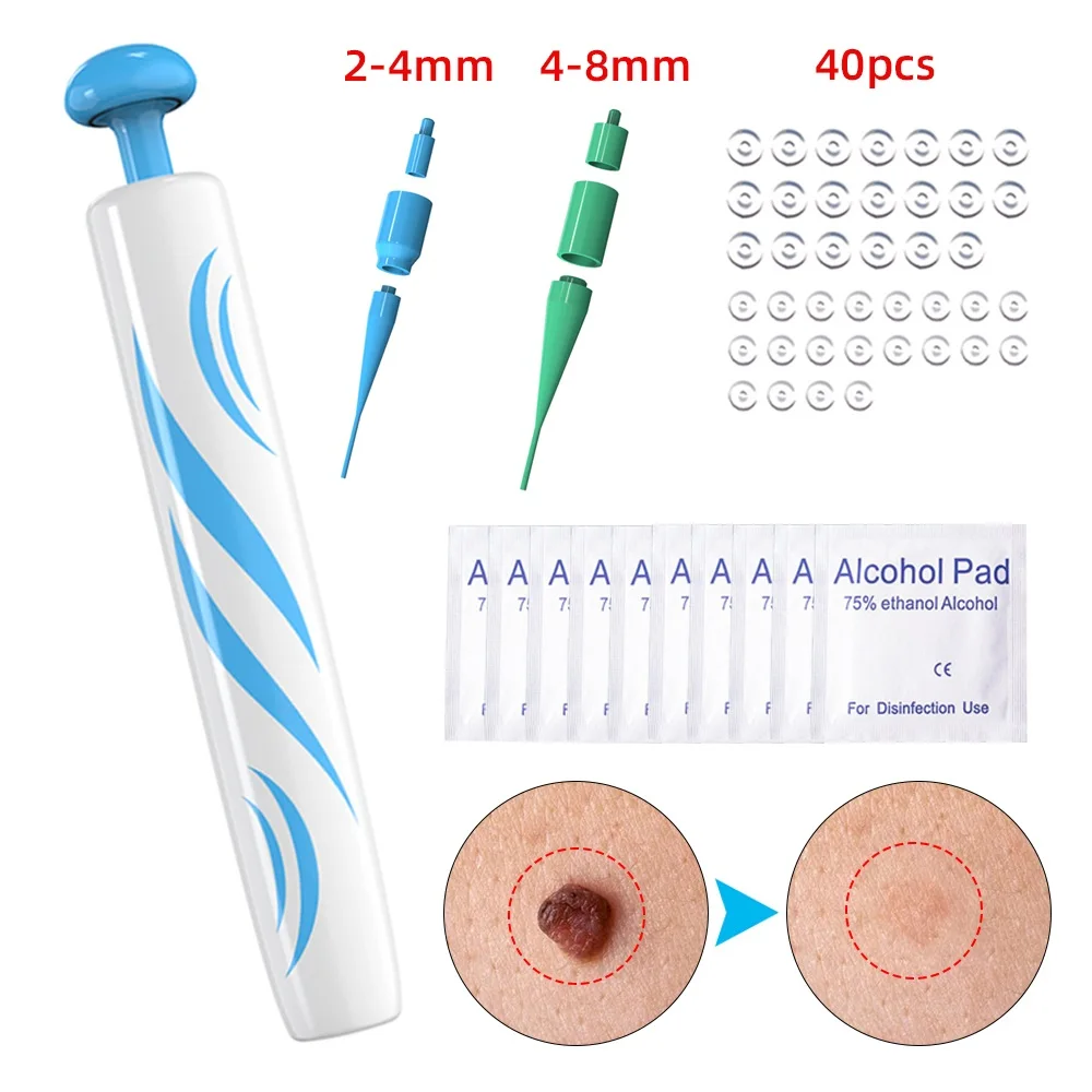 

Wart Remover Pen Painless Tag Removal Kit 40x Rubber Bands+10x Alcohol Pad Body Wart Treatment Corn Remover With Cleansing Swabs