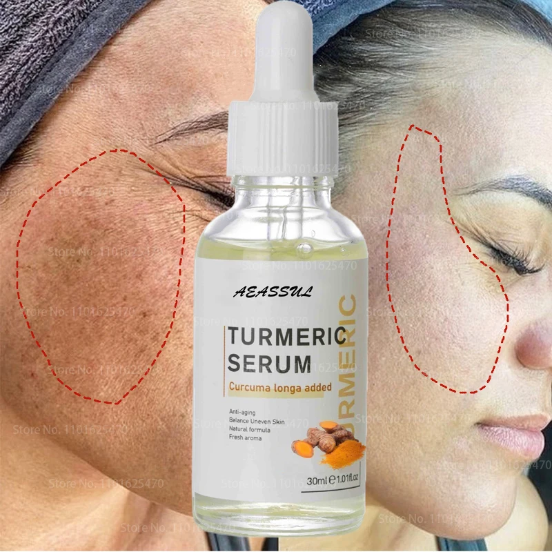

30ML Turmeric Face Serum Whitening Dark Spot Remover Acne Scar Bright Skin Corrector Facial Essence Improve Roughness Skin Care