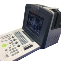 s 830 portable ultrasound scanner
