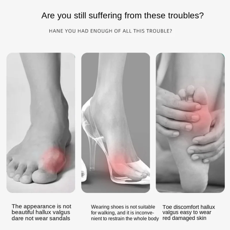 1 Pair Toe Silicone Bunion Guard Foot Care Orthopedic Toe Separators Finger Toe Separator Correction Pad Forefoot Pad Heels