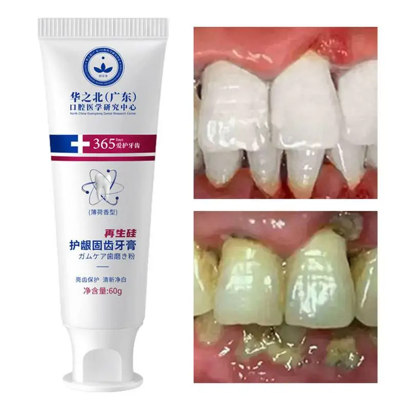 

Repair Toothpaste 60g Teeth Brightening Cleansing & Gum Restore Toothpaste Mint Flavor Intensive Complete Protection Toothpaste