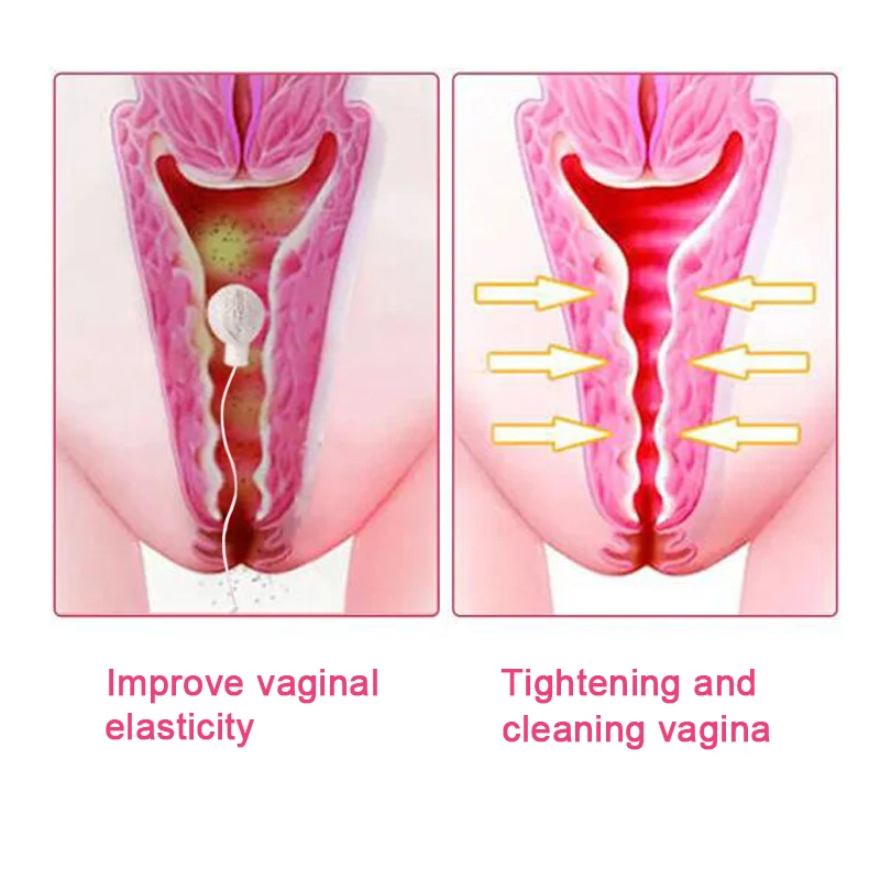 20 шт. гинекологические тампоны для лечения влагалища