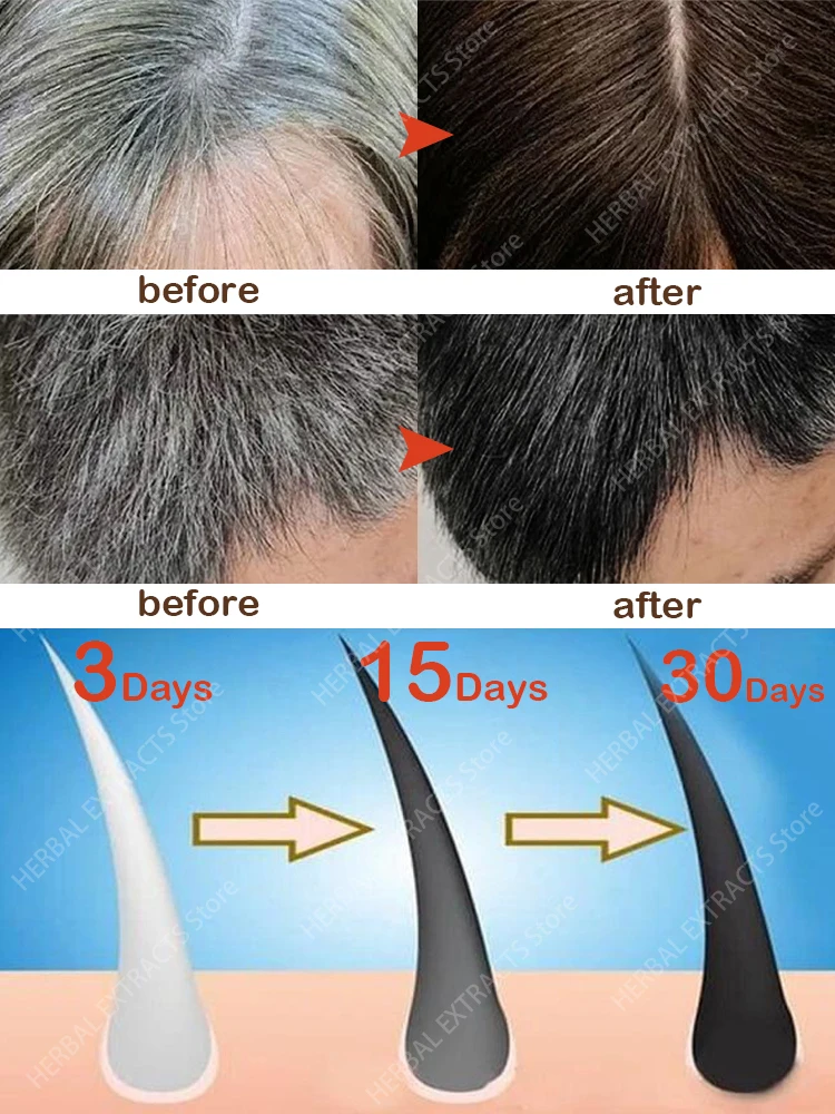 

Gray Hair Serum