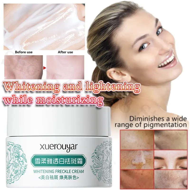 

Herbal Freckle Cream Face Brightens Skin Tone Fades Dark Spots Moisturizes and Repairs Skin Freckles and Whitening Cream