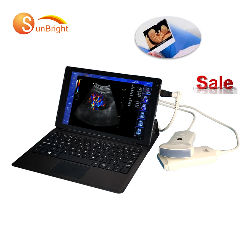 

Sunbright SUN-901A Convex Color Doppler Digital Ultrasound USG Scanner Medical Ultrasound Instruments