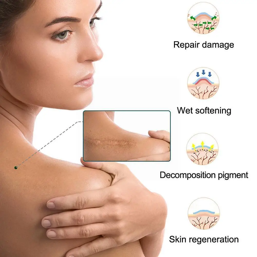 

1 roll Fade Scar Stickers Silicone Gel Tape Efficient Scar Gel Burn Gel Patch Scar Removal Beauty Silicone Acne Silicone N6H4