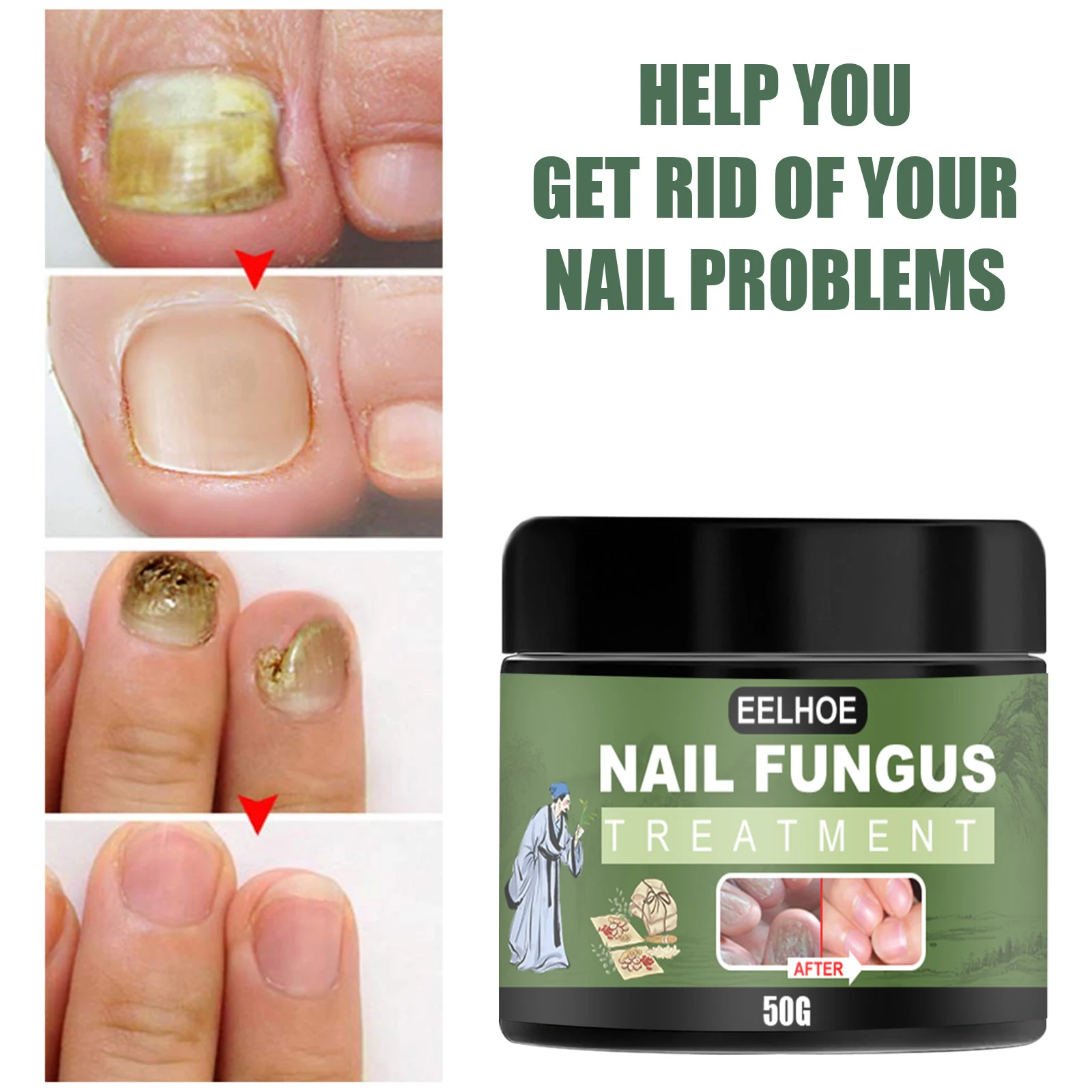 

Nail Repair Cream Onychomycosis Paronychia Anti Fungal Nail Ointment Toe Nail Fungus Serum Feet Health Care 50g