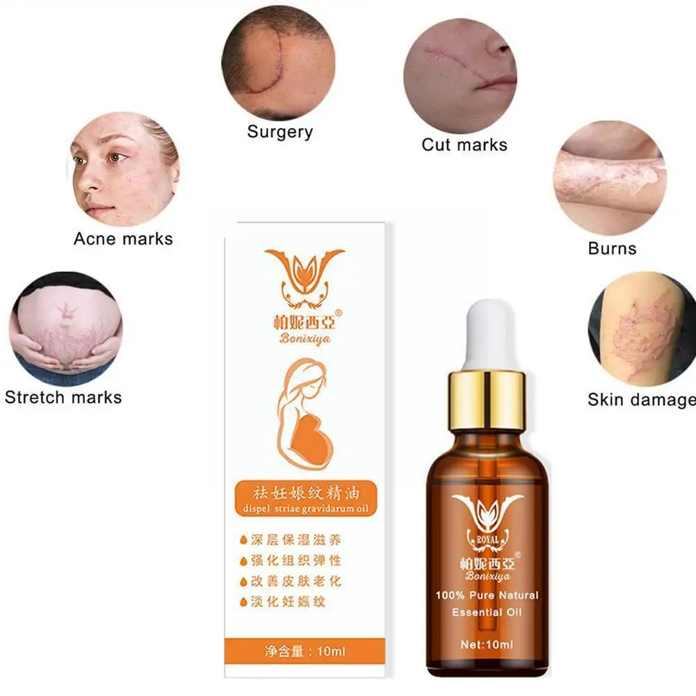 

Stretch Marks Remover Essential Oil Natural Safety Treatment Cream For Stretch Mark Removal Maternity Slackline Skin Care 1 T7H0