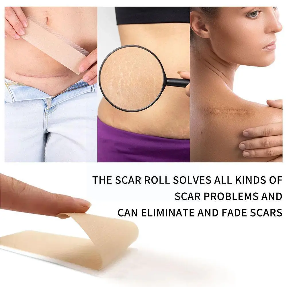 

4*150cm Surgery Scar Removal Silicone Gel Patch Treatment Scar Trauma Skin Tape Sheet Repair Tools Efficient Therapy Burn A A9u9