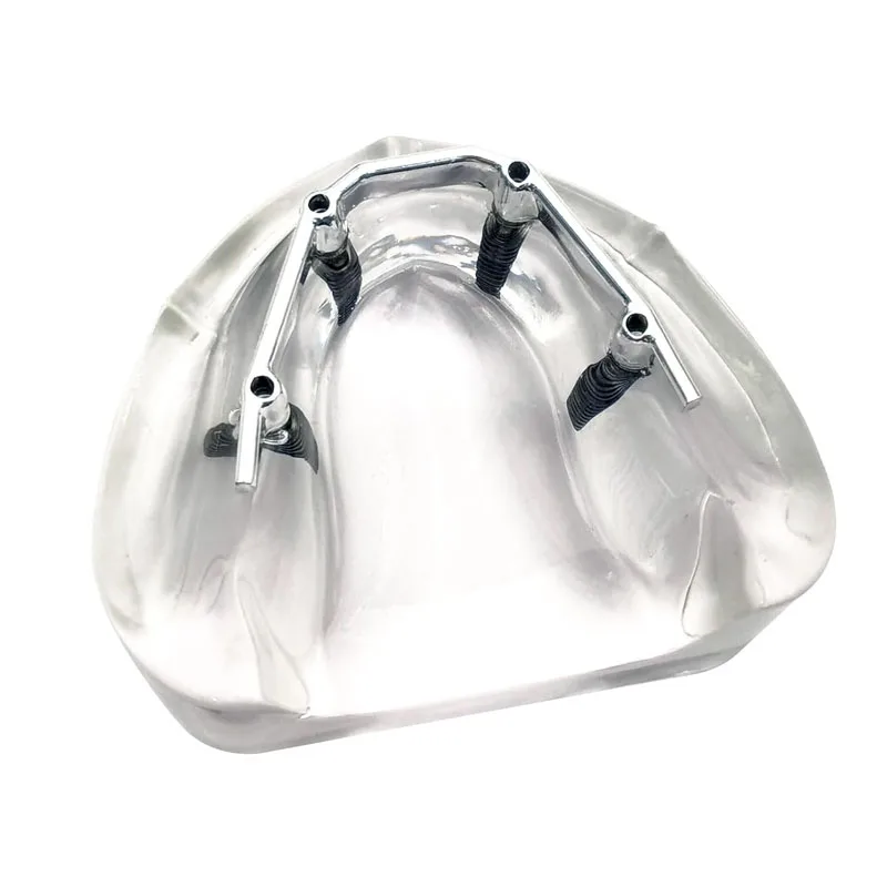 Зубной имплантат модель зубов 4 имплантаты зубной протез серебряный стержень