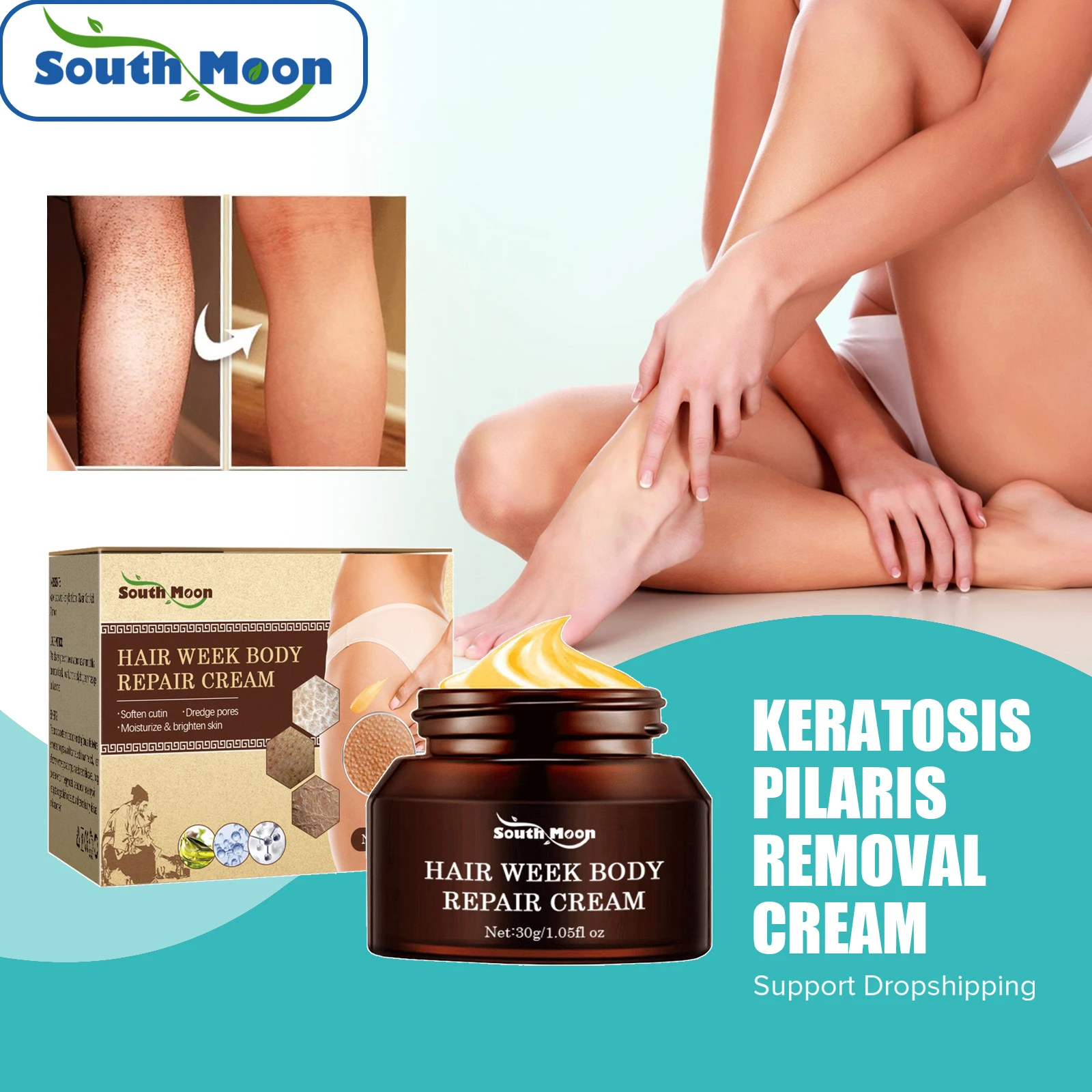 

South Moon Keratosis Pilaris Removal Cream Chicken Skin Folliculities Treatment Repair Whitening Moisturizing Smooth Body Lotion
