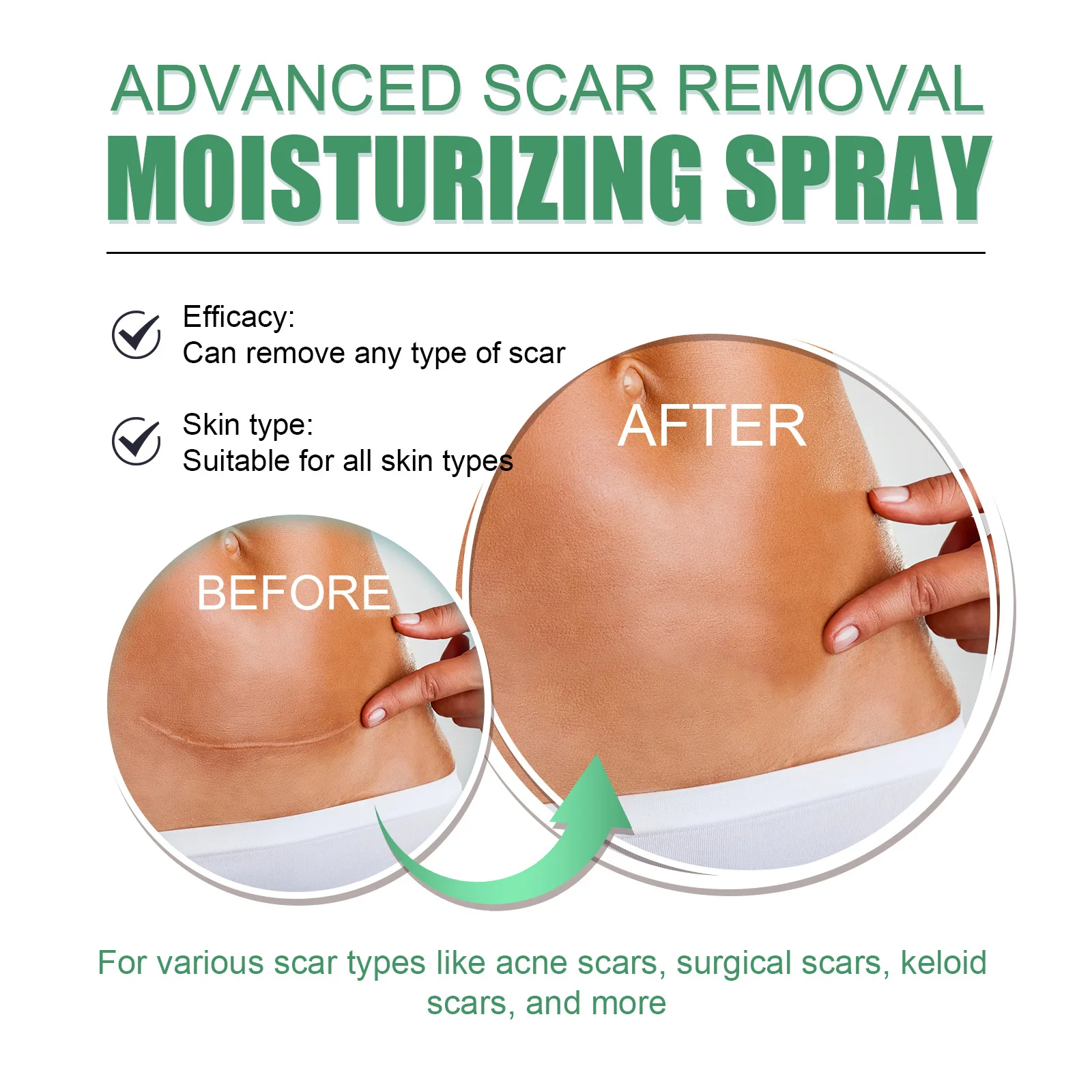 Рисунок 5 - Крем для удаления шрамов спрей