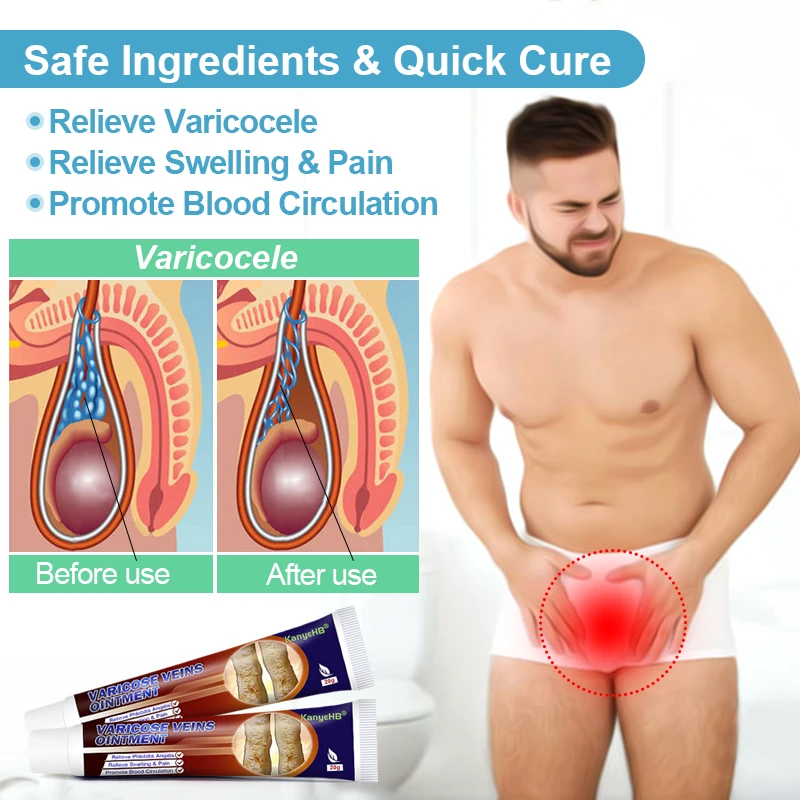 1/3/5/7 шт. травяной крем для лечения варикозного расширения вен |