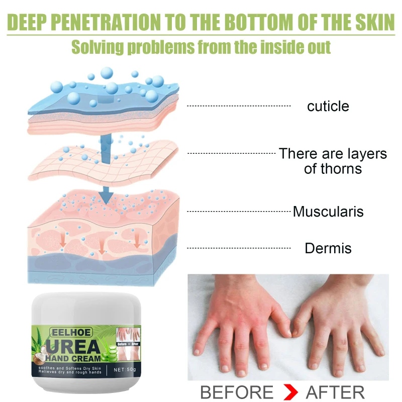 

Urea Moisturizing Hand Creams Hydrating Anti-cracking Anti-drying Hand Creams Lightening Hand Lines Non-greasy Hand Skin Creams