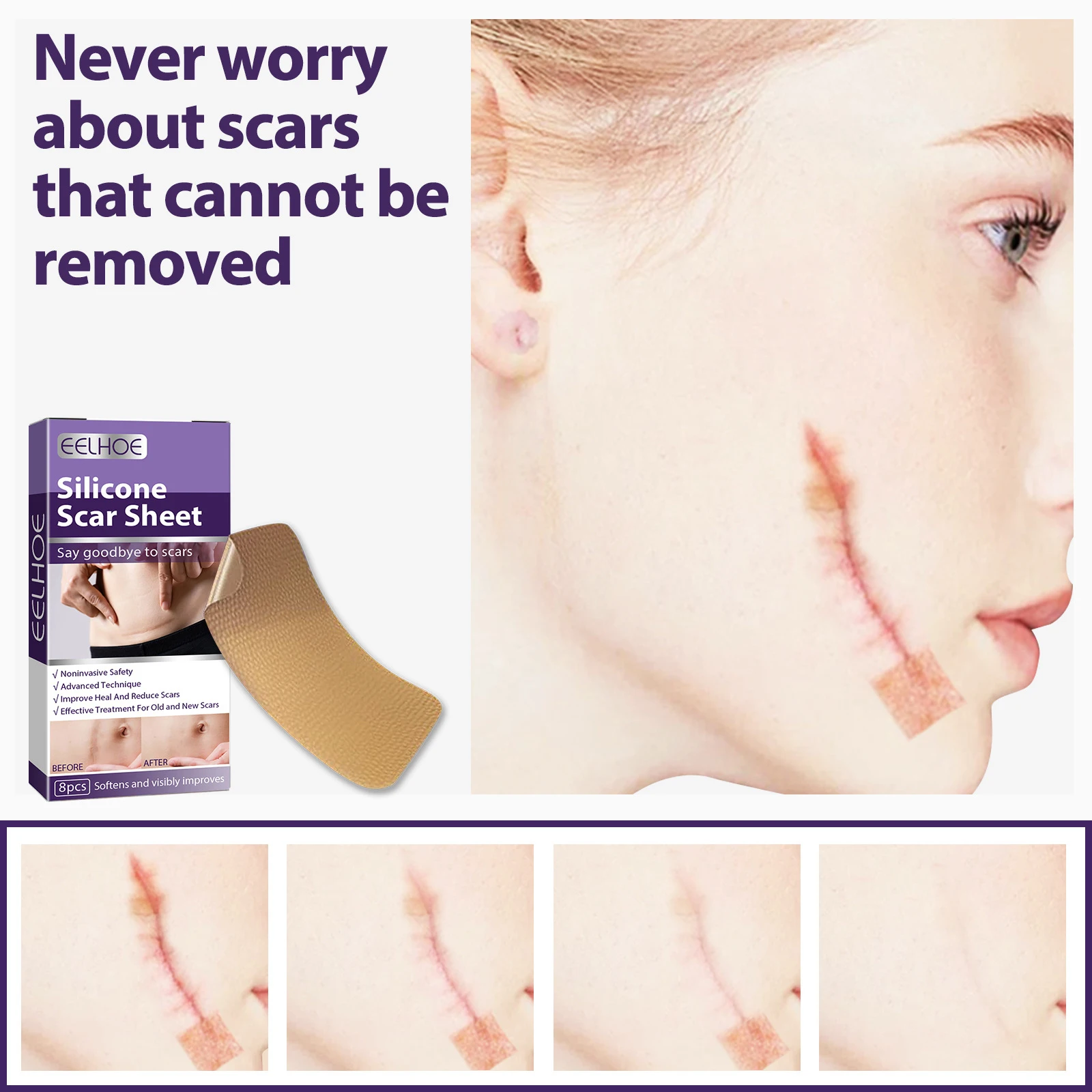 

8pcs/box Scar Repair Patch Surgery Self-Adhesive Silicone Gel Tape Removal Scar Sheets Efficient Repair Damaged Skin Sheet Skin
