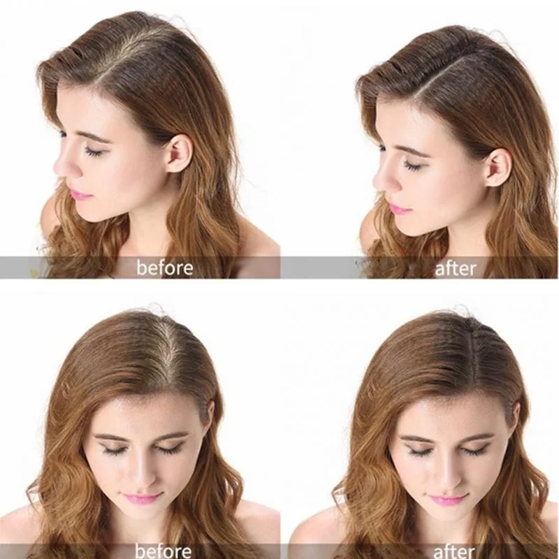 Масло для роста волос природное стимулирует восстановление фолликулов раньше