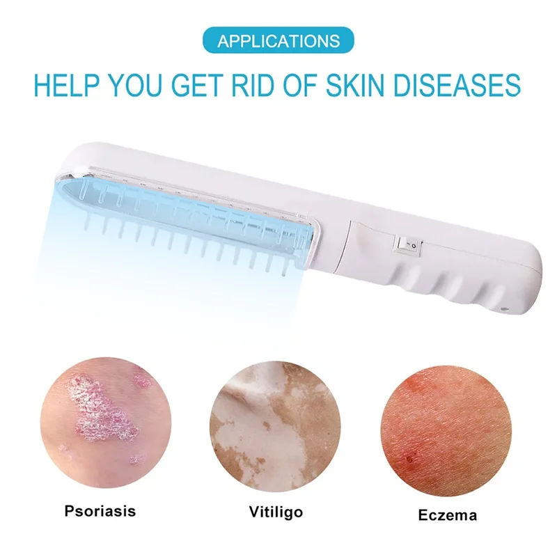 Уфв 311нм узкая лента лампа для фототерапии инструмент лечения псориаза Vitiligo