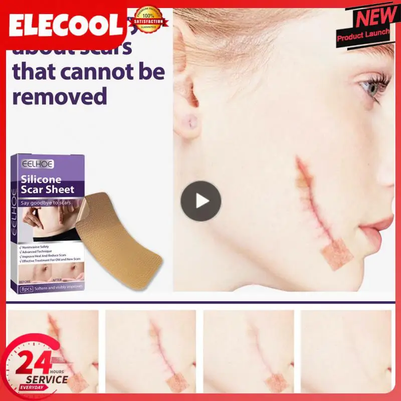 

/box Scar Repair Patch Surgery Self-Adhesive Silicone Gel Tape Removal Scar Sheets Efficient Repair Damaged Skin Sheet Skin