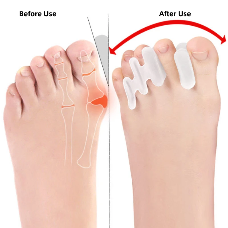 16 шт. = 8 пар силиконовый разделитель пальцев с тремя отверстиями гель для защиты