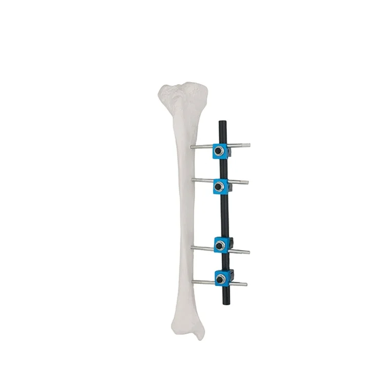 

AO fixator lower limb External Fixator Straight type for Tibia