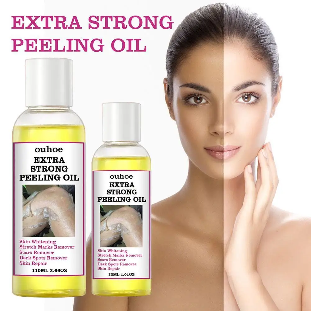 

30/110ML Extra Strong Yellow Peeling Oil Whitening Lighten Elbows Knees Hands Melanin Even Skin Tone Whiten Skin Care