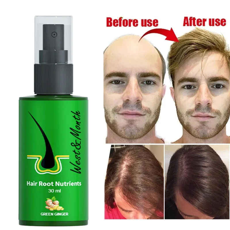

Ginger Hair Growth Spray Hair Loss Treatment Essential Oils Fast Grow Prevent Hair Dry Frizzy Damaged Thinning Repair Care 30ml