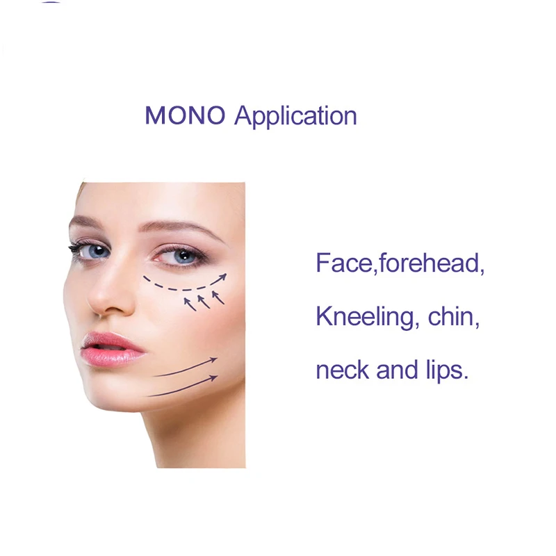 

2022 Hot selling 100pcs Pdo thread Mono Screw thread for lifting and wrinkle removal Mono PCL PDO OLLA Thread