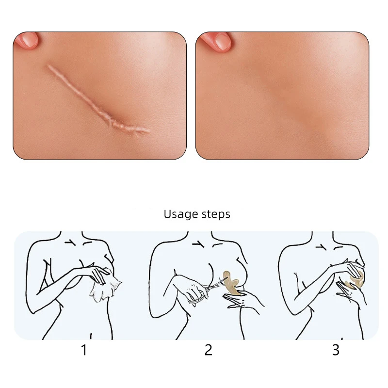 Многоразовые силиконовые гелевые невидимые наклейки круглая дуга грудь