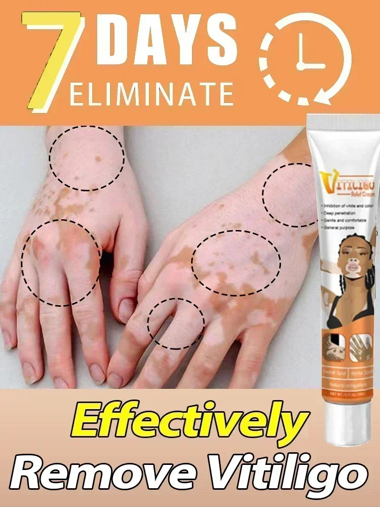 Разгладьте кожу и Попрощайтесь с зудом проблемами кожи восстановите уверенность