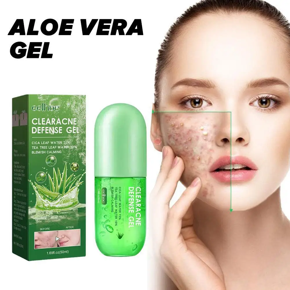 

Aloe Vera Gel ClearAcne Defense Treatment Remove Acne Cream Repair Day Care Body Skin Sunburn Scar Moisturizer A1M6