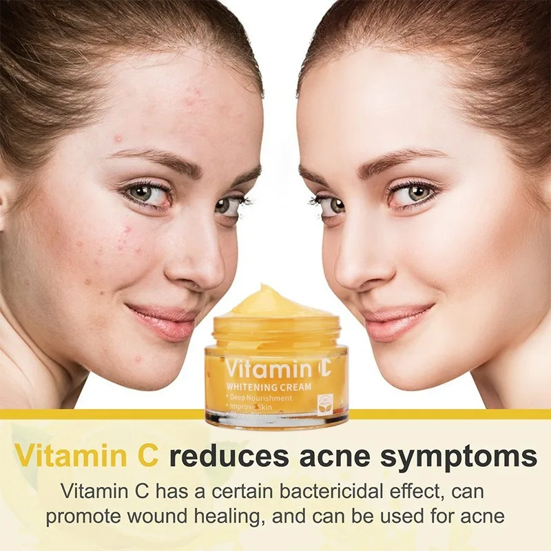 

Vitamin C Whitening Cream Organic Glowing Skin Anti-Aging, Rejuvenating, Boosting Collagen Hydrating for Dull, Dry Moisturizing
