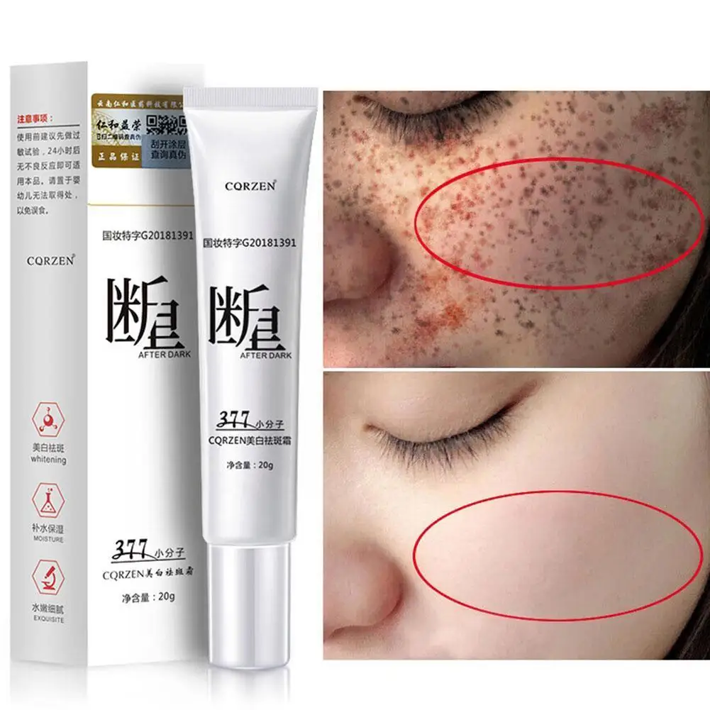 

Whitening Freckles Cream Remove Melasma Dark Spot Dark Face Spots Face Firming Lift Care Essentials Beauty Skin A8W4