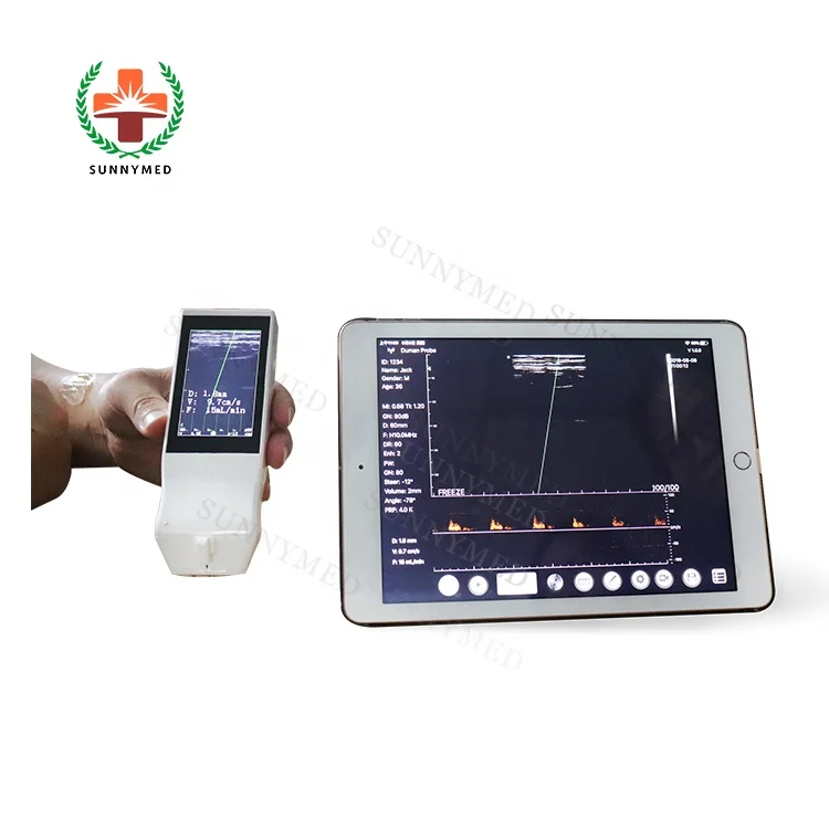 

SY-AC50 Wireless Ultrasound Probe Color Doppler Waterproof Probe for Sale