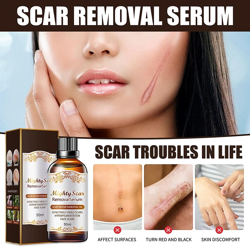 

Scar Serum Scar Treatment Serum for Both Old And New Scars Easy to Apply Scar Fading Make Scars Smaller & Less Visible Serum