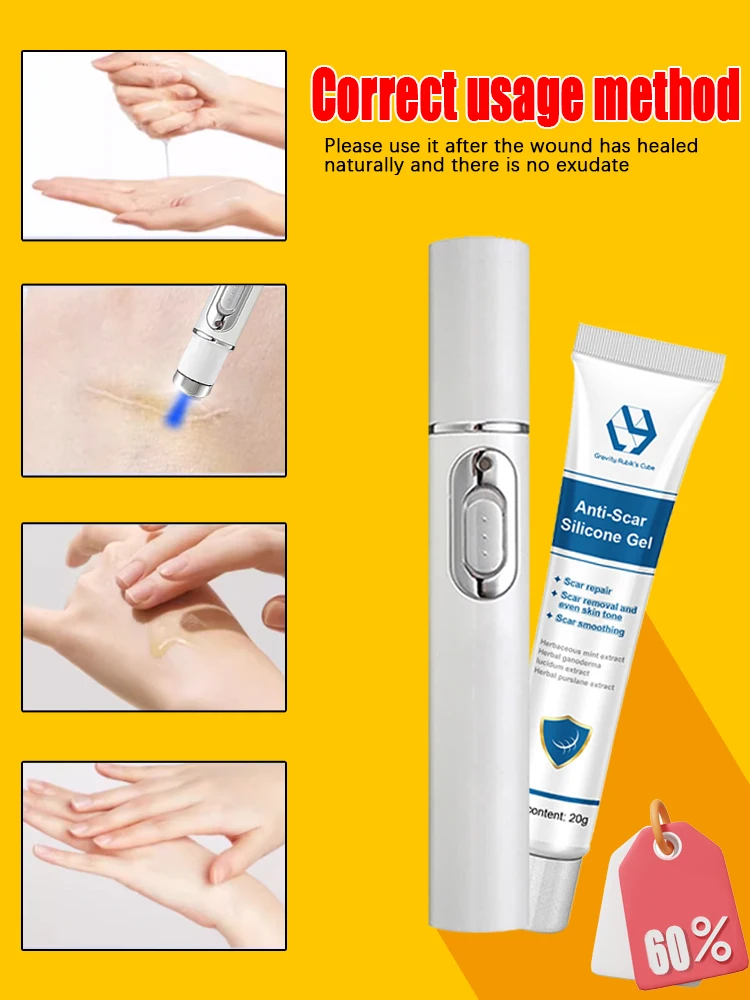 Горячая Распродажа лазерный ремонт шрамов на коже.